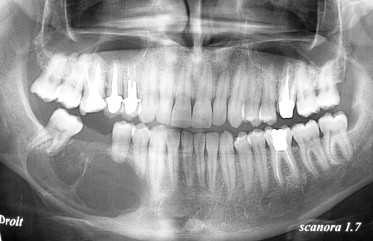 Pathologie dento-maxillaire